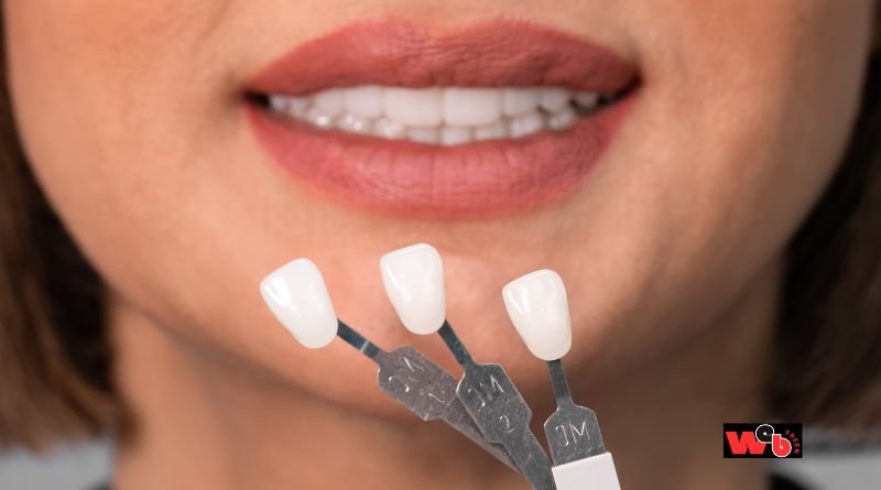 Dental Implants in Thunder Bay